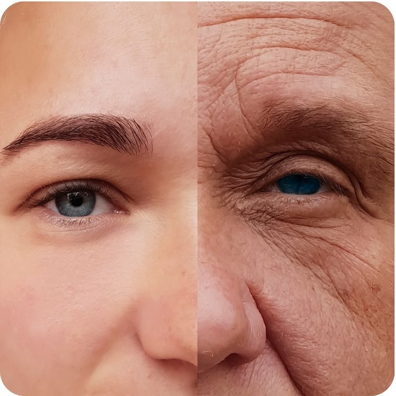 Image showing how glycation affects the skin.