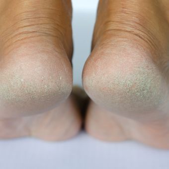 Image of a persons heels standing on their tippy toes.