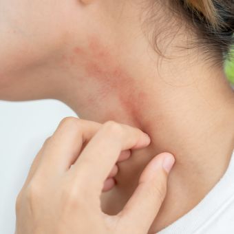 Image of a person scratching their neck.