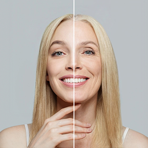 woman with young clean skin and wrinkles. Aging and youth, aesthetic surgery, beauty treatment and cosmetology concept.