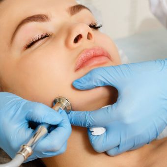 Esthetician performing mircodermabrasion on a client
