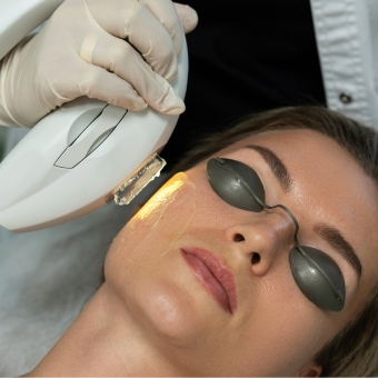 Esthetics client with protective eyeware receiving an IPL service from a provider