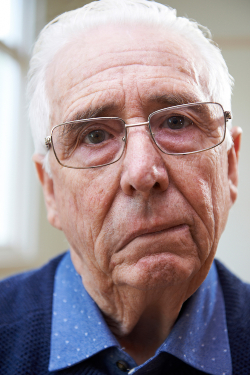Older gentleman showing facial weakness on one side of face. 