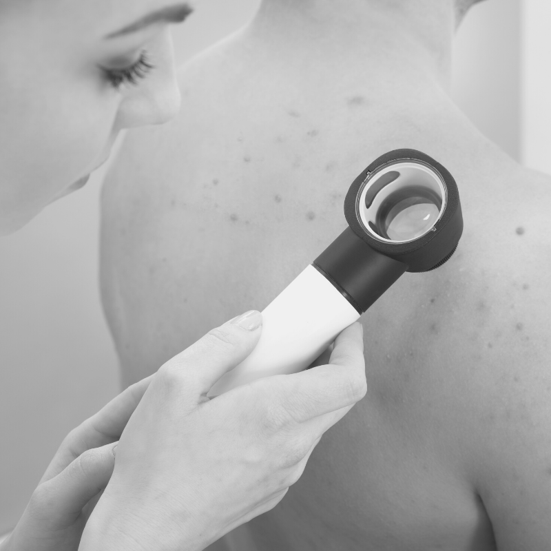 woman examines client's shoulder with dermatoscope
