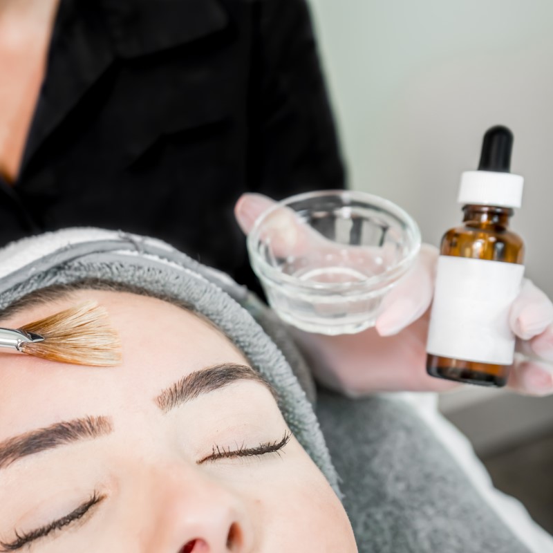 esthetician applies a chemical peel