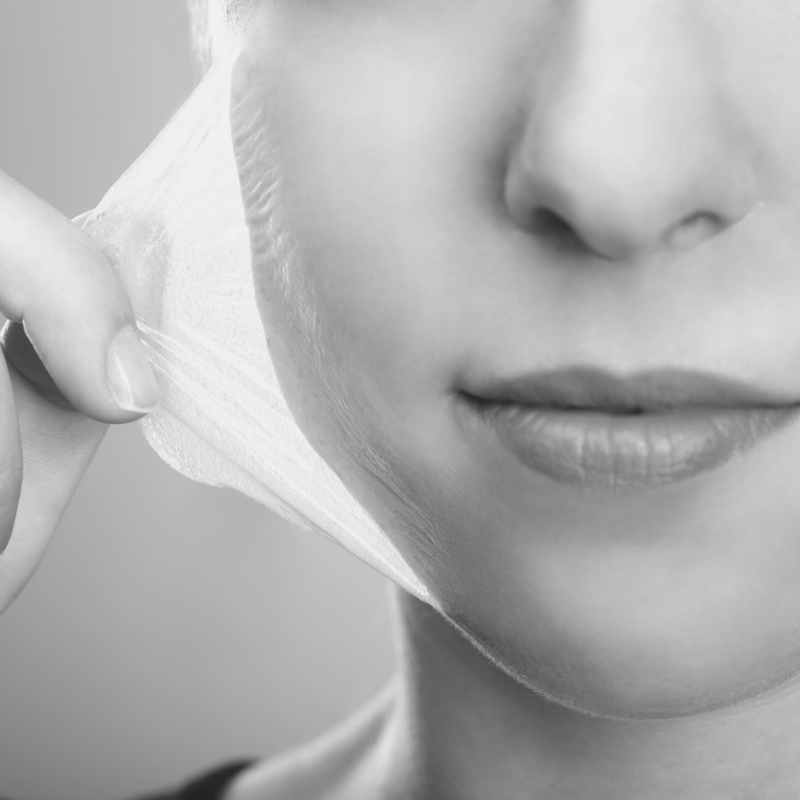 A woman peeling off a medical peel on her face to rejuvinate the skin.