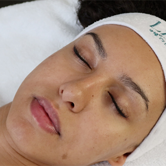 Facial skin before peptide treatment