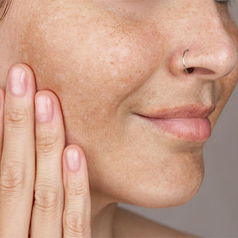 Lira Skin Care