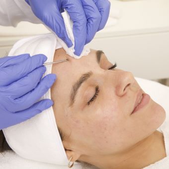 Esthetician performing extracts on client's skin