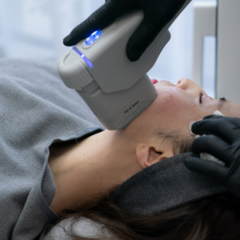 Skin Deep Magazine - High Intensity Focused Ultrasound. Girl receiving HIFU treatment