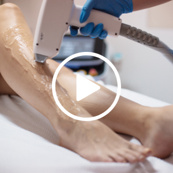 Woman receives laser hair removal on lower leg