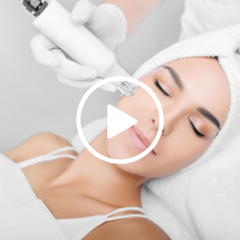Esthetician performing IPL — IPL photo rejuvenation and photofacials with play button overlay 
