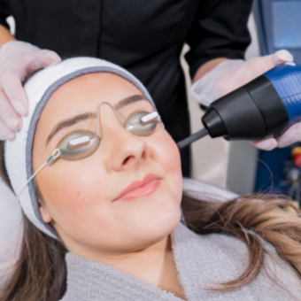ASCP Member performs CO2 Fractional Laser
