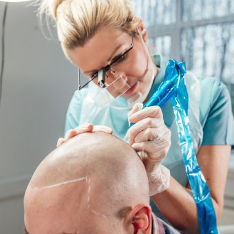 scalp micropigmentation